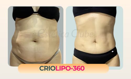 Crio Barriga mais plana e definida